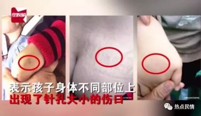 5名幼儿园老师涉嫌虐待被刑拘，幼儿园负责人...